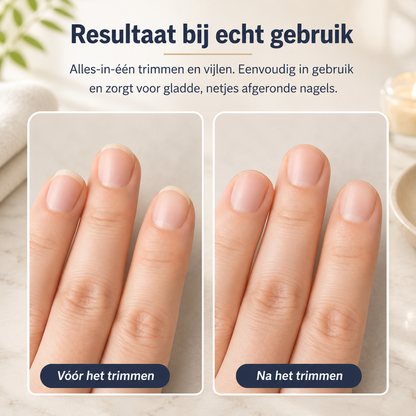 NagelTrimmer® | Draagbare Elektrische Nageltrimmer